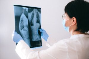 Cauda equina syndrome negligence: claiming for delayed diagnosis