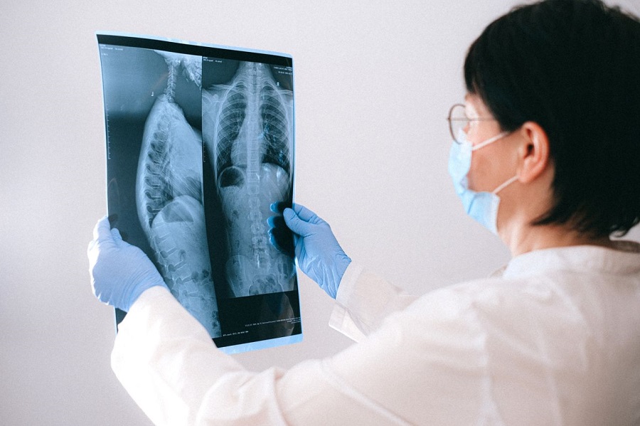 Cauda equina syndrome negligence claiming for delayed diagnosis